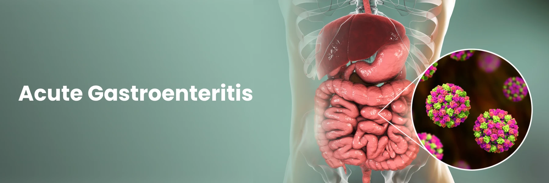 Saiba mais sobre gastroenterite aguda: causas e medidas preventivas