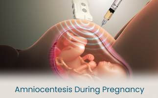 Why Amniocentesis Is Performed During Pregnancy