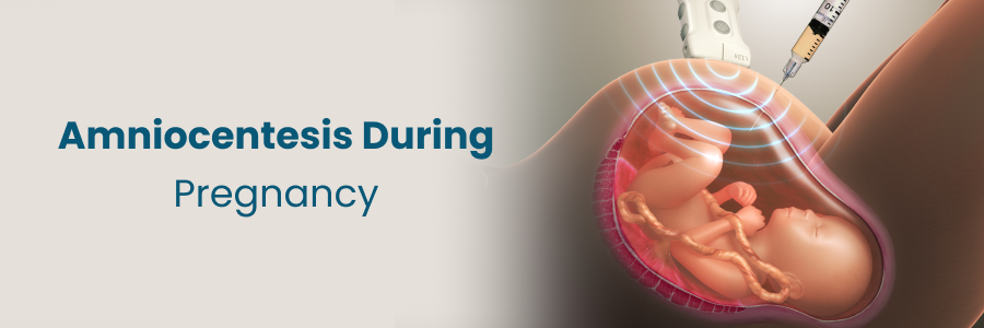 Amniocentesis During Pregnancy