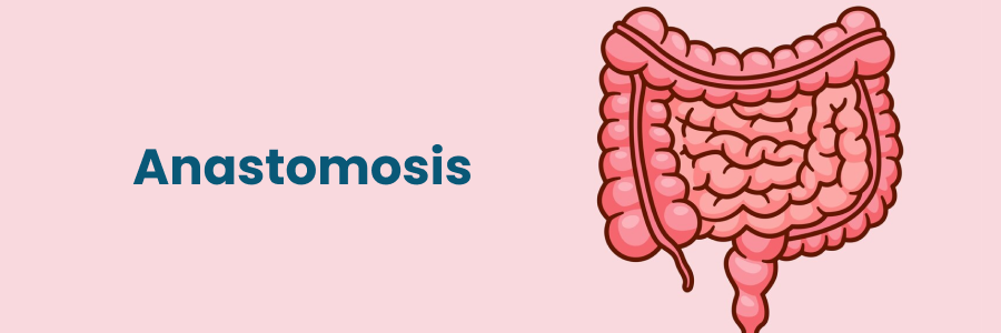 Anastomosis