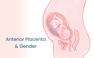 Anterior Placenta and Gender