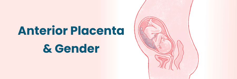 Anterior Placenta And Gender