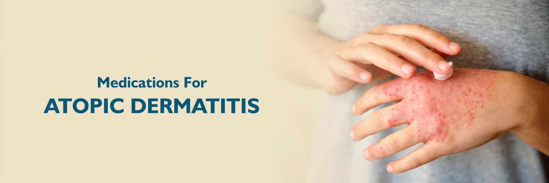 Atopic Dermatitis Medication