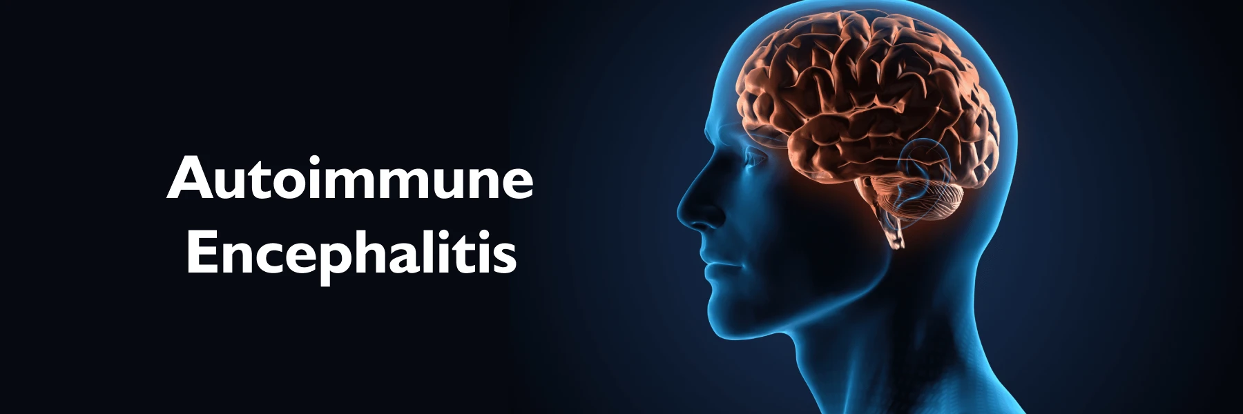 Autoimmune Encephalitis