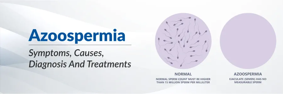 Azoospermia