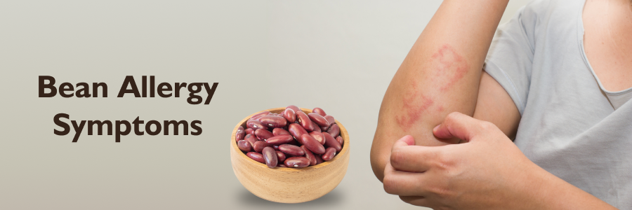 Bean Allergy Symptoms