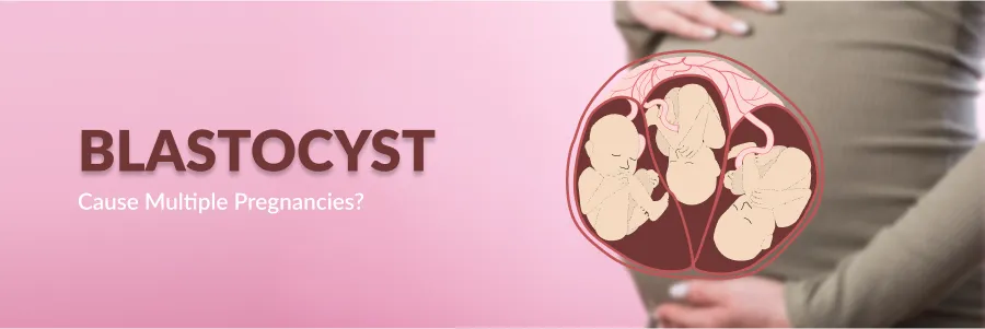 Blastocyst Multiple Pregnancies