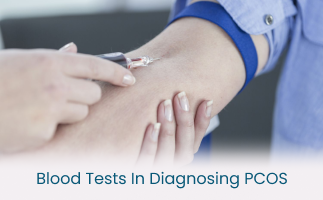 Know the Role of Blood Tests in Diagnosing PCOS