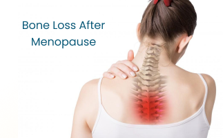 How to Prevent the Causes of Bone Loss After Menopause