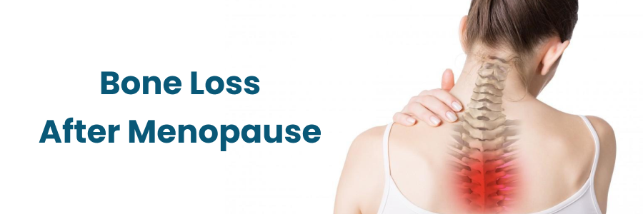 Bone Loss After Menopause