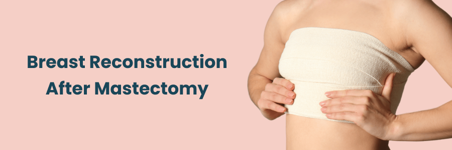 Breast Reconstruction After Mastectomy