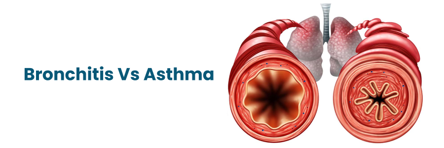 bronchitis vs asthma