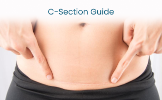 CSection Essential Guide for Moms