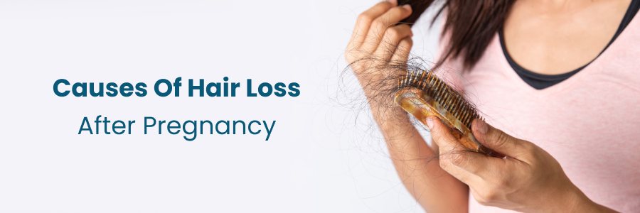 Causes Of Hair Loss After Pregnancy