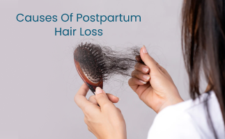 Common Causes of Postpartum Hair Loss in Women