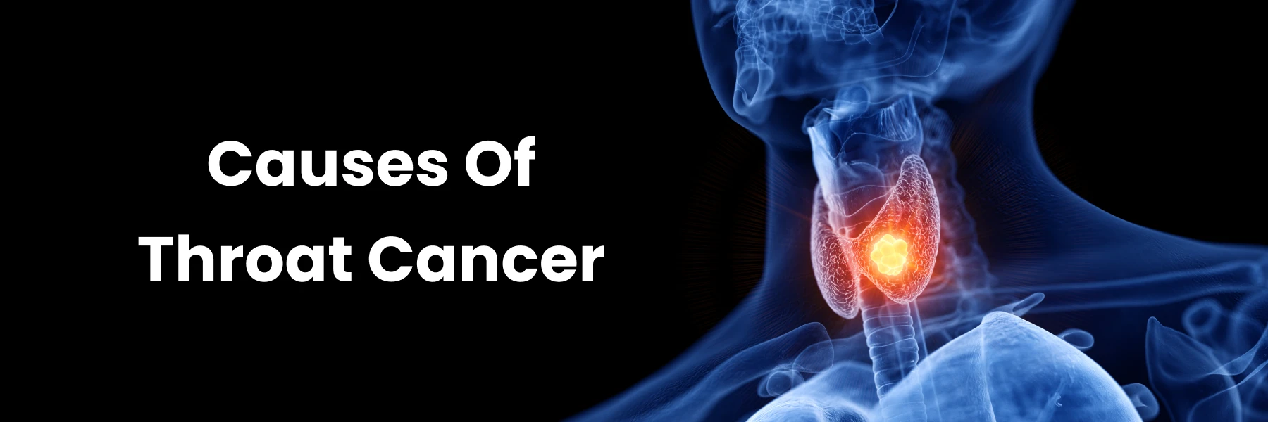 Throat Cancer Causes: From Smoking to Genetic Factors