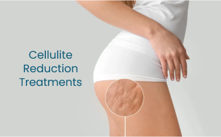 Effective Cellulite Reduction Treatments What Works Best for Women