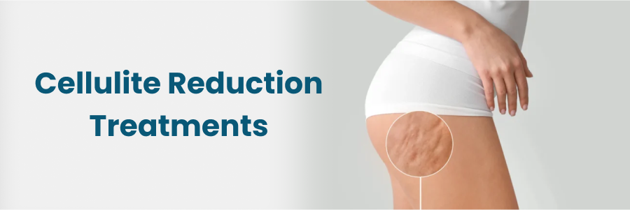 Cellulite Reduction Treatments