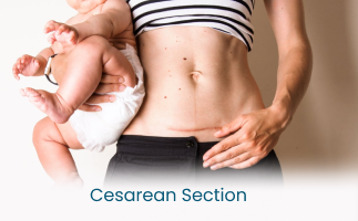 Managing Chronic Pain After Cesarean Section CSection