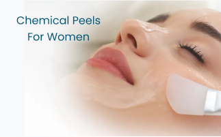 Chemical Peels for Women What to Expect