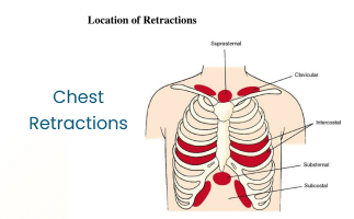 Causes and Treatment for Chest Retractions