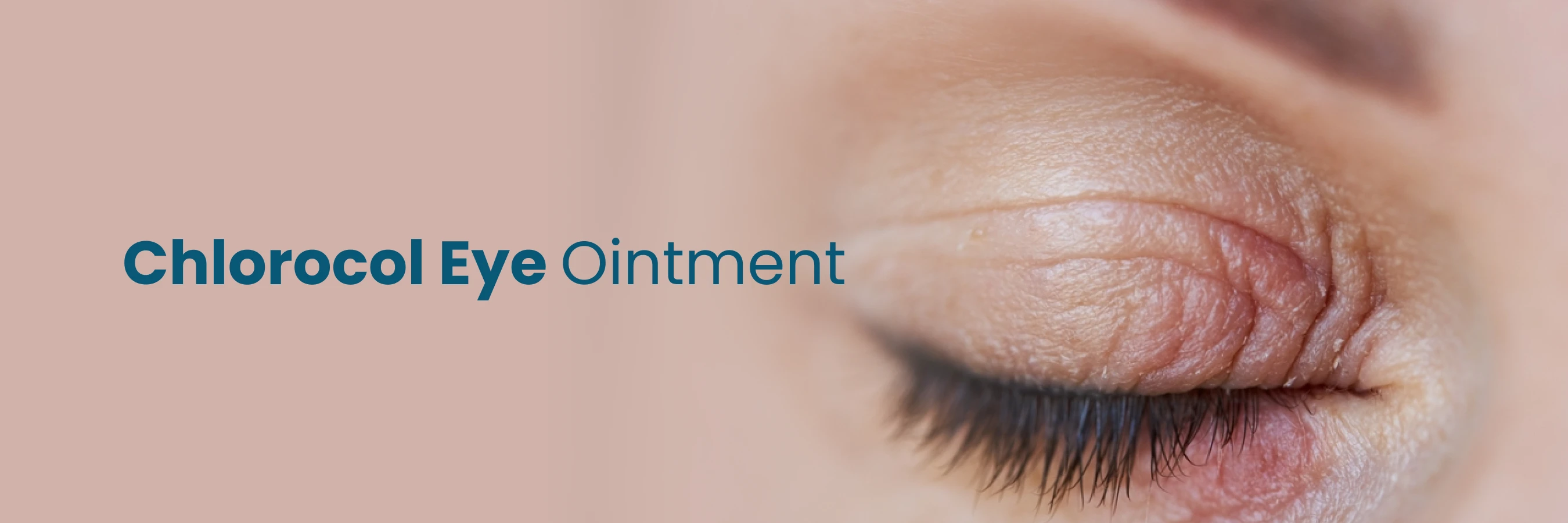 chlorocol eye ointment