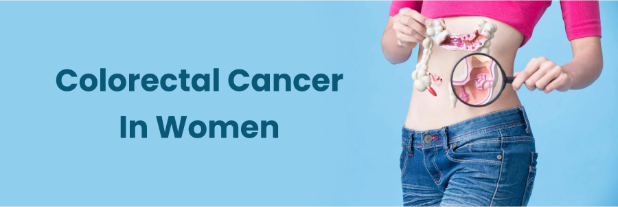 Colorectal Cancer In Women