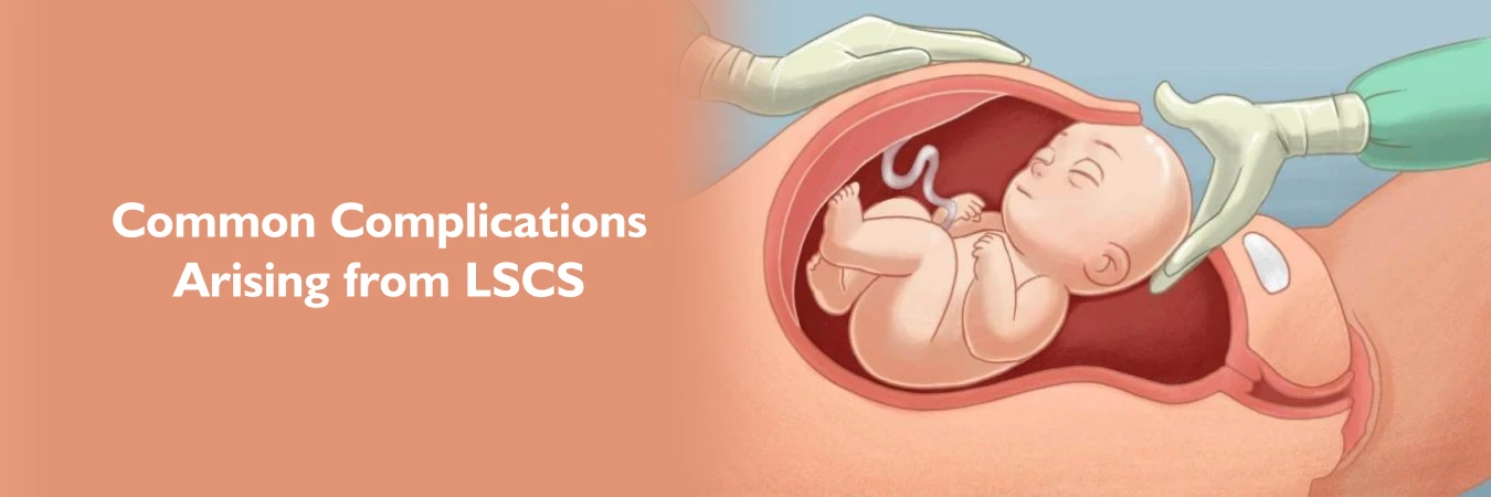 Common Complications arising from LSCS