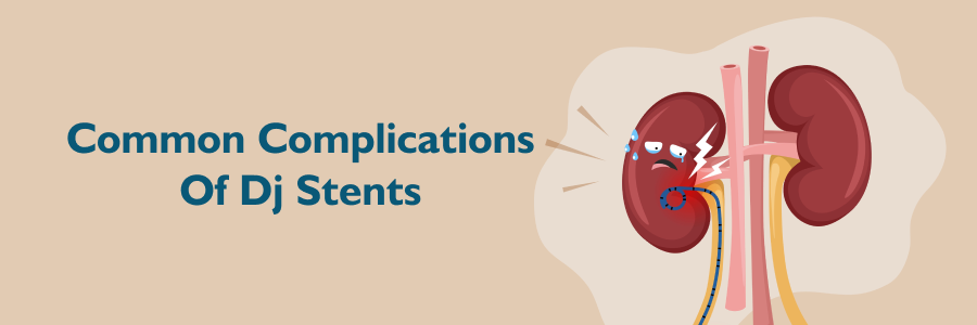 Common Complications of DJ Stents