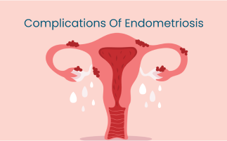 Complications of Endometriosis How to Manage Pain