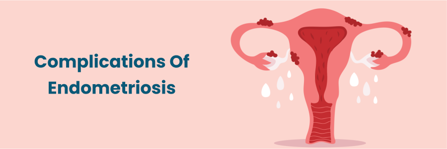 Complications Of Endometriosis