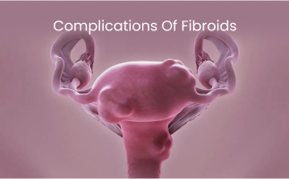 Complications of Fibroids How They Affect Womens Health