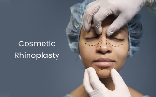 Achieve Facial Balance with Cosmetic Rhinoplasty