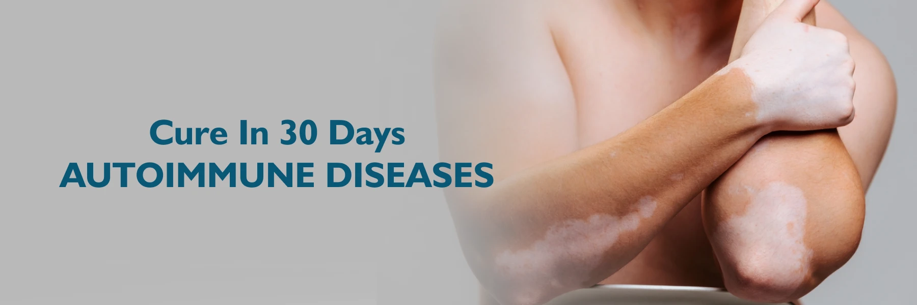 Cure Autoimmune Disease in 30 Days