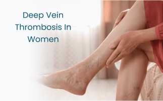 Deep Vein Thrombosis DVT in Women Risk Factors Symptoms