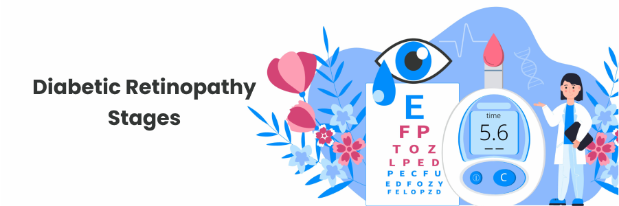 diabetic retinopathy stages
