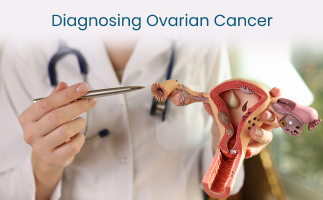 Diagnosing Ovarian Cancer Ultrasound and Blood Tests