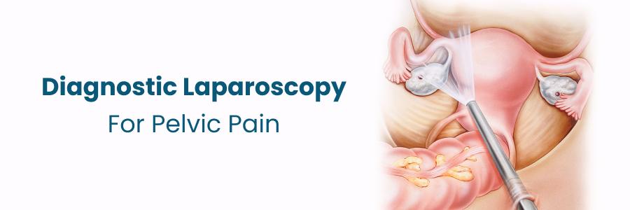 Diagnostic Laparoscopy For Pelvic Pain