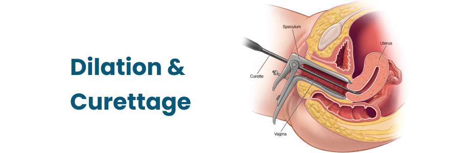 Dilation And Curettage