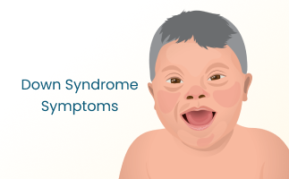 Common Down Syndrome Symptoms and Treatment