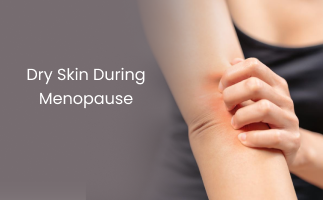 Dry Skin During Menopause Causes and Solutions