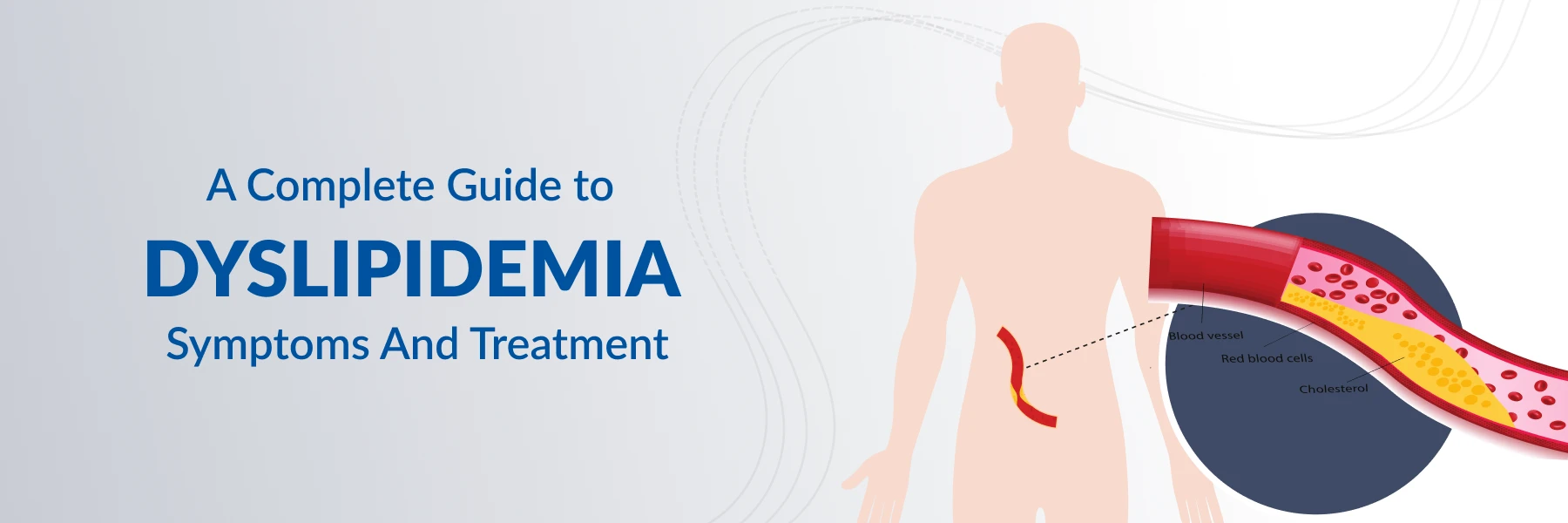 Dyslipidemia