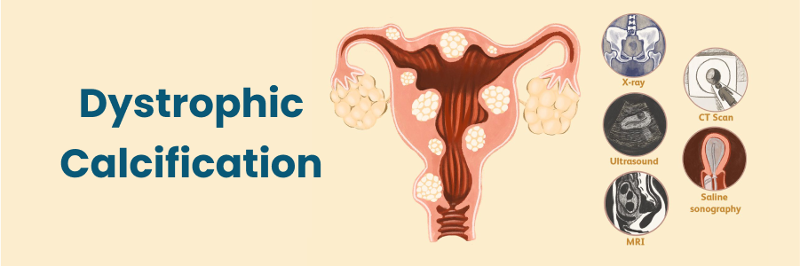 Dystrophic Calcification