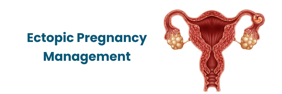 Ectopic Pregnancy Management