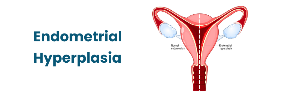 Endometrial Hyperplasia: What Women Should Know About This Condition