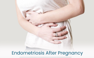 Managing the Symptoms of Endometriosis After Pregnancy