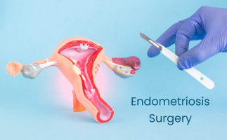 Endometriosis Surgery Types Benefits Recovery process