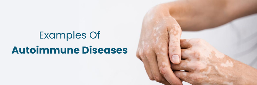 Common Examples of Autoimmune Diseases