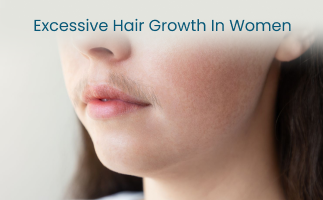 Excessive Hair Growth in Women  Medicover