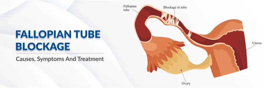 Fallopian tube blockage